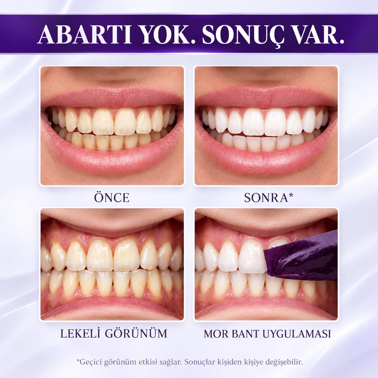 DentaLume V34 Mor Diş Beyazlatma Bantları