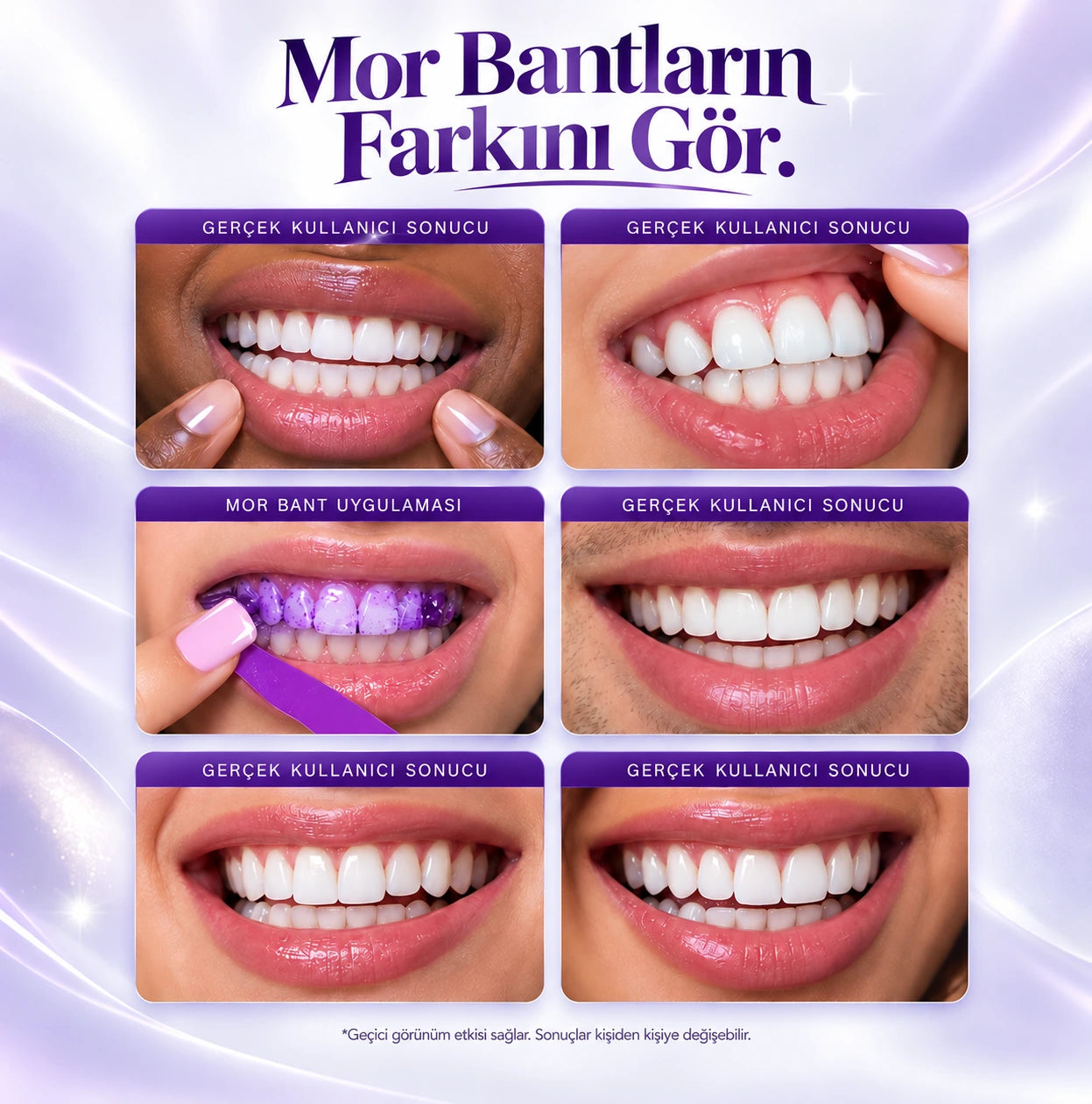 DentaLume V34 Mor Diş Beyazlatma Bantları