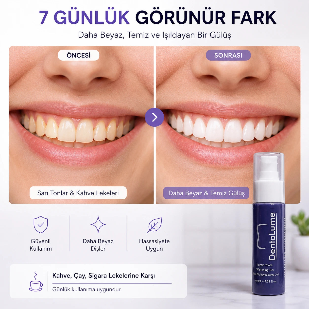 DentaLume™ Purple Color Correcting Gel
